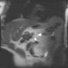 MRI abdomen 4