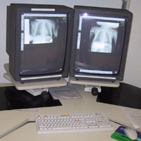 digitalisatie in radiologie